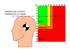 Limfouzel se ha hinchado sobre el cuello el tratamiento