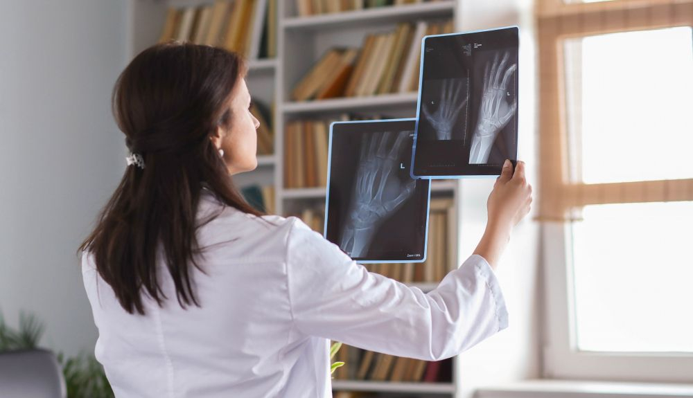 Las fracturas de huesos por fragilidad han aumentado considerablemente en los últimos tiempos. Las fracturas de huesos por fragilidad han aumentado considerablemente en los últimos tiempos.