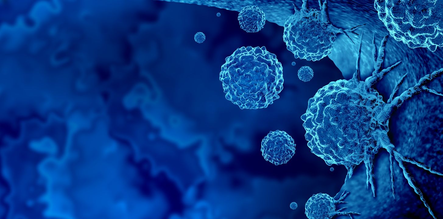 Brote de cáncer y tratamiento de células cancerosas malignas en un cuerpo humano.