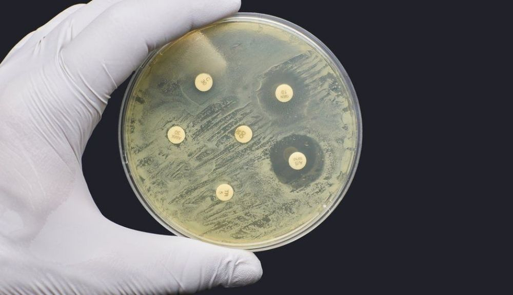 Prueba de laboratorio de resistencia a los antimicrobianos. Prueba de laboratorio de resistencia a los antimicrobianos.