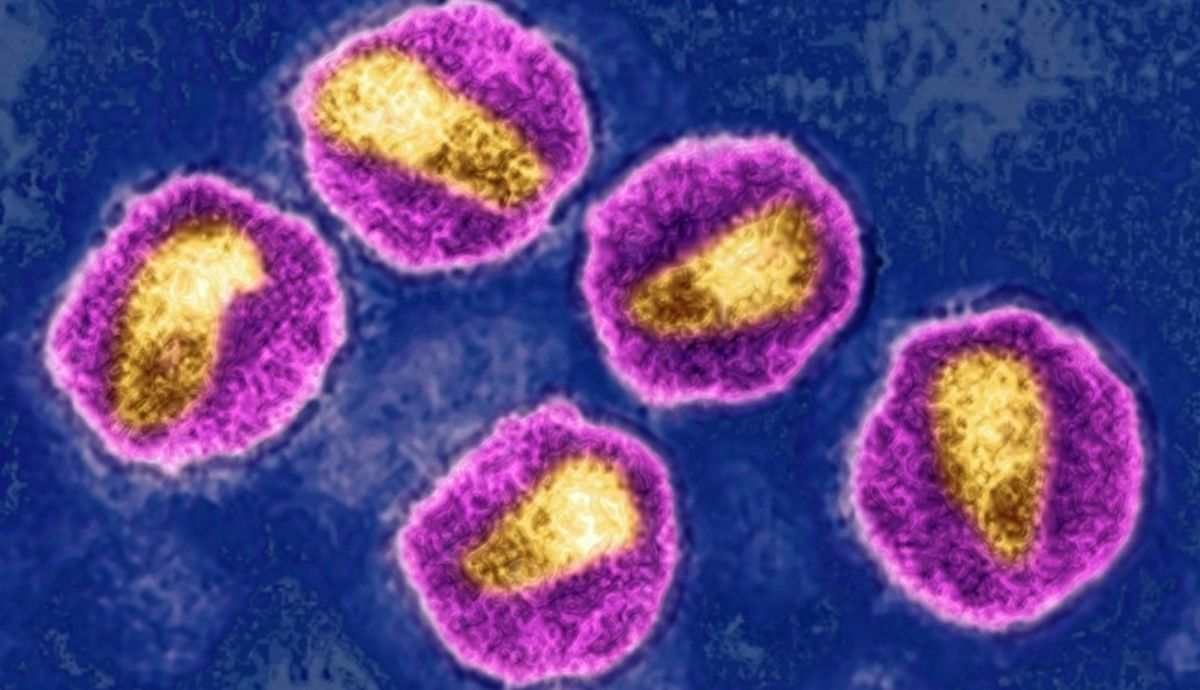 La variante aumenta el número de partículas del virus del VIH en la sangre de las personas infectadas.