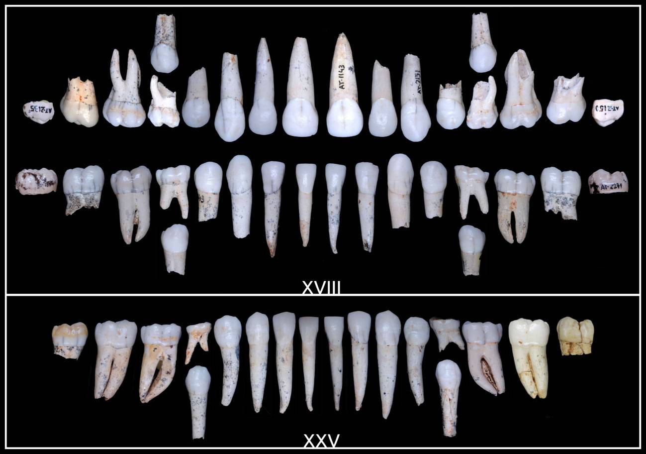 Dientes procedentes de la Sima de los Huesos, en Atapuerca.