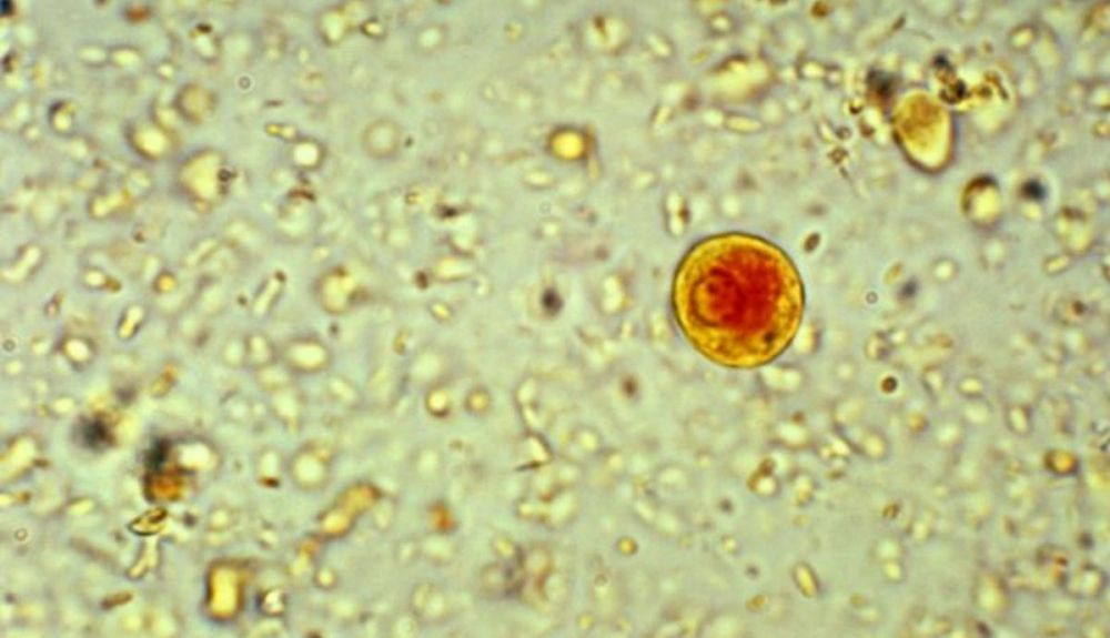 Entamoeba histolytica es un parásito intestinal humano. Puede causar colitis, diarrea severa y disentería. Entamoeba histolytica es un parásito intestinal humano. Puede causar colitis, diarrea severa y disentería.