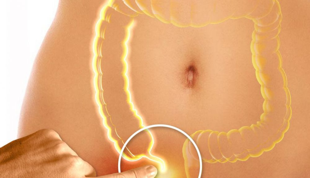 El apéndice es una pequeña estructura parecida a un gusano, con un extremo ciego en la unión del intestino grueso y el delgado. El apéndice es una pequeña estructura parecida a un gusano, con un extremo ciego en la unión del intestino grueso y el delgado.