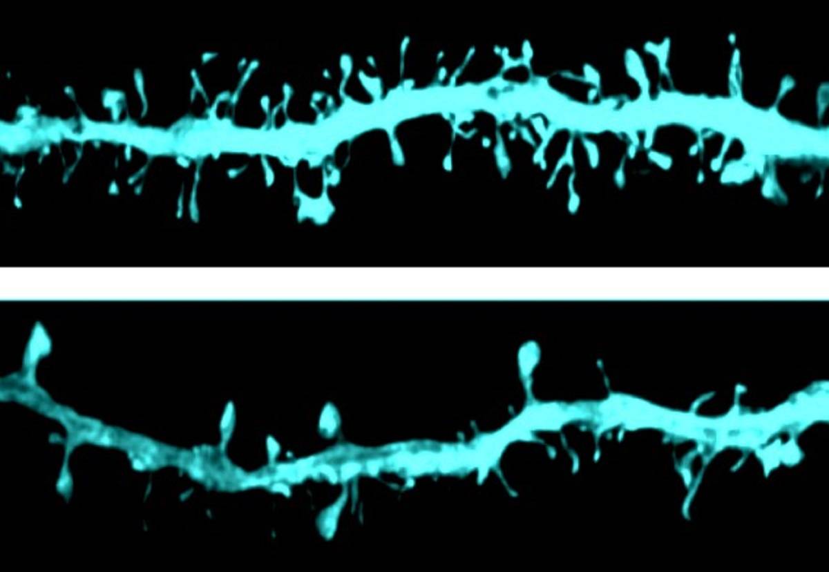 Imagen de las espinas dendríticas, donde se produce la sinapsis. Se observan diferencias entre un grupo control, en la foto superior, y un grupo experimental, en la foto inferior.