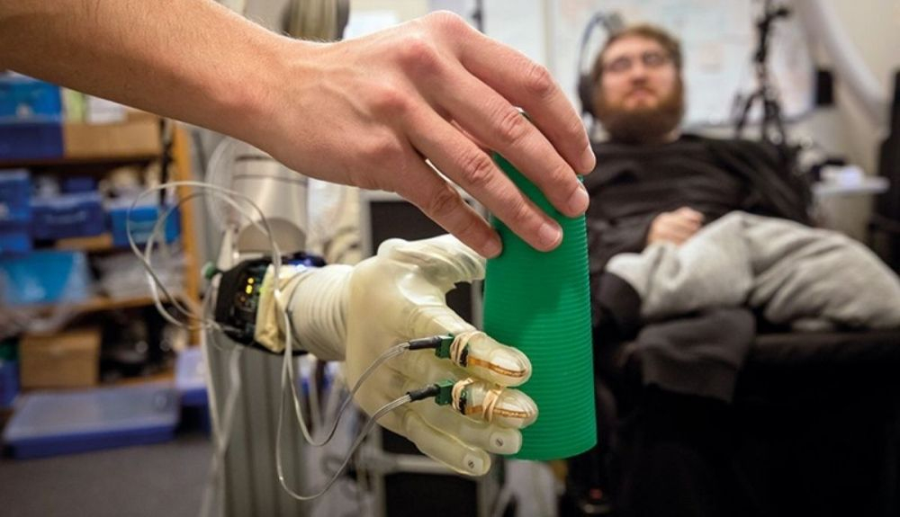 Nathan Copeland (al fondo) puede experimentar el tacto a través de un emparejamiento de implantes cerebrales con una mano robótica. Nathan Copeland (al fondo) puede experimentar el tacto a través de un emparejamiento de implantes cerebrales con una mano robótica.