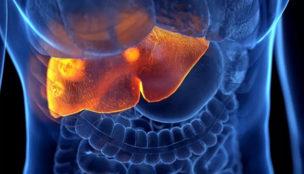 La hepatitis es una enfermedad inflamatoria que afecta al hígado. La hepatitis es una enfermedad inflamatoria que afecta al hígado.