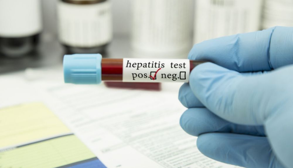 La OMS aconseja que se realicen análisis de sangre para detectar estos casos de hepatitis. La OMS aconseja que se realicen análisis de sangre para detectar estos casos de hepatitis.