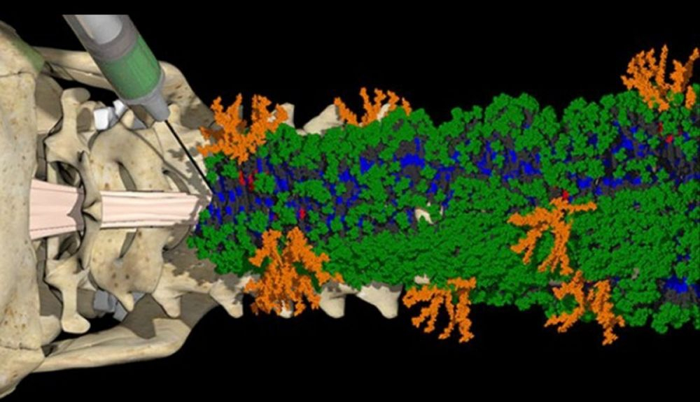 Investigadores de la Universidad Northwestern han aplicado una nueva clase de moléculas danzantes para reparar tejido en lesiones graves de la médula espinal y revertir con éxito la parálisis.