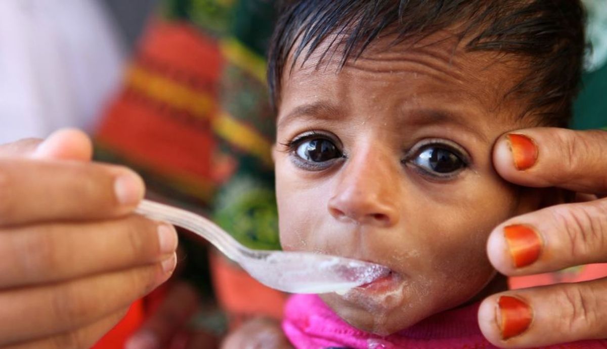 UNICEF advierte que la desnutrición infantil crecerá considerablemente.