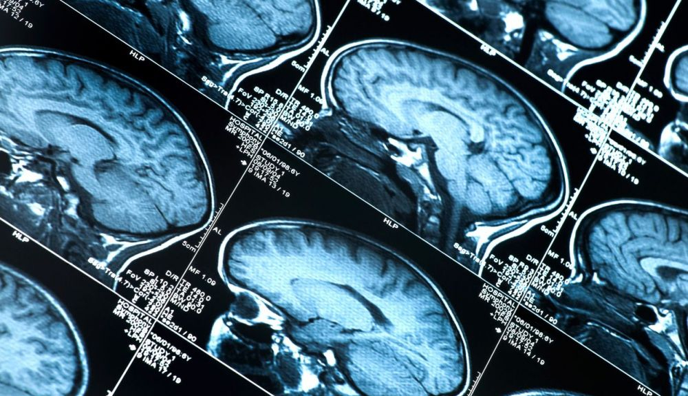 El equipo utilizó neuroimágenes de 50 cerebros humanos y 29 de chimpancés escaneados de forma similar a los humanos. El equipo utilizó neuroimágenes de 50 cerebros humanos y 29 de chimpancés escaneados de forma similar a los humanos.