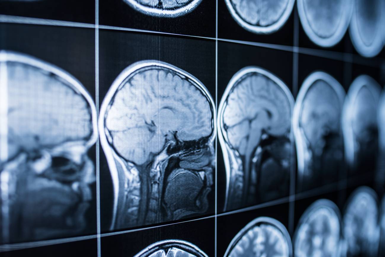 Investigadores han obtenido pistas sobre cómo evolucionó nuestro cerebro hasta estar preparado para el lenguaje.
