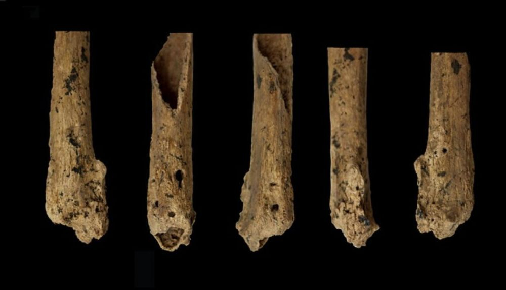La tibia izquierda (izquierda dos imágenes) y el peroné izquierdo de un individuo que vivió hace unos 31.000 años muestran sitios de amputación curados La tibia izquierda (izquierda dos imágenes) y el peroné izquierdo de un individuo que vivió hace unos 31.000 años muestran sitios de amputación curados