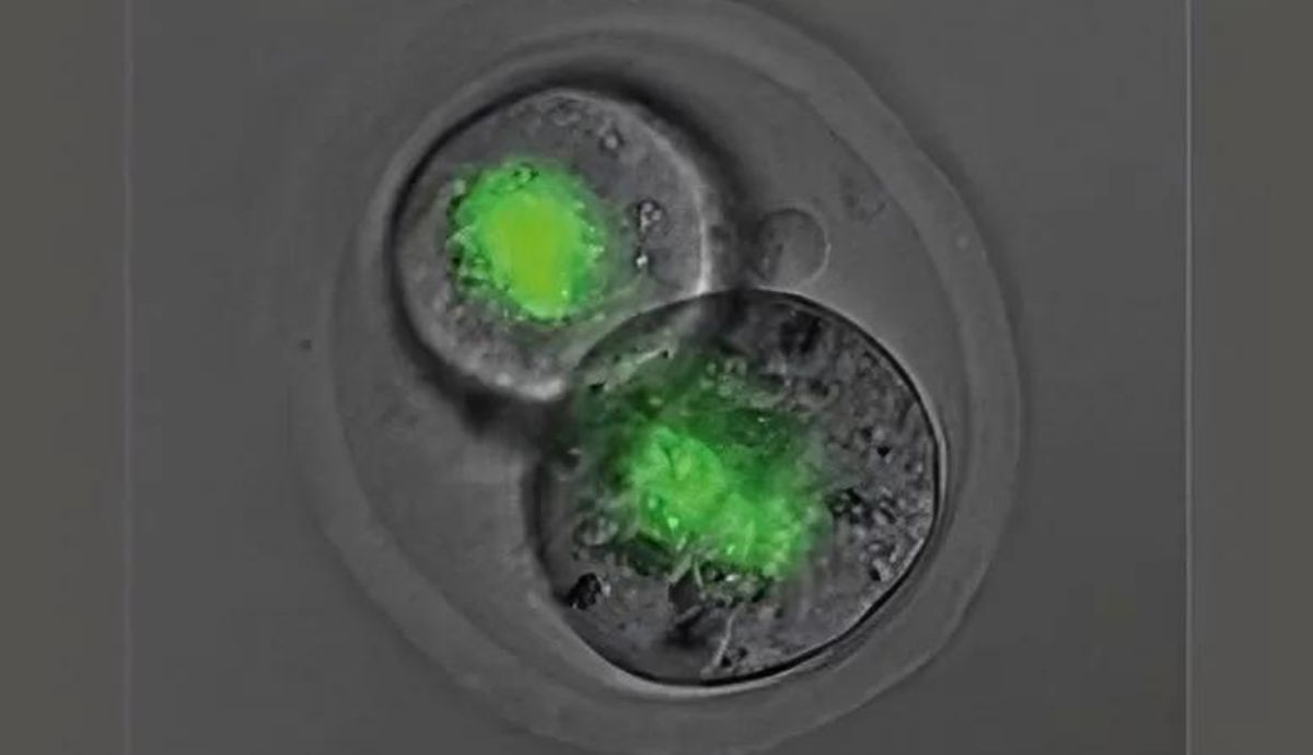 Estos estudos sobre la epigenética han versado sobre la proteína SMCHD1.