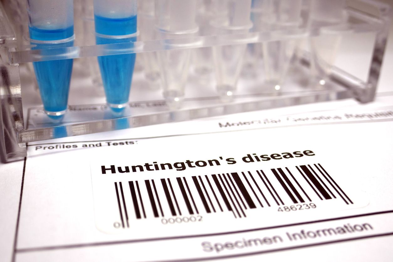 Este estudio amplía la comprensión de los mecanismos subyacentes de la enfermedad de Huntington.