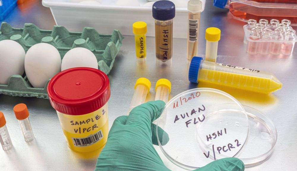 Existen decenas de combinaciones del subtipo de influenza A, siendo H5N1 una de ellas. Existen decenas de combinaciones del subtipo de influenza A, siendo H5N1 una de ellas.