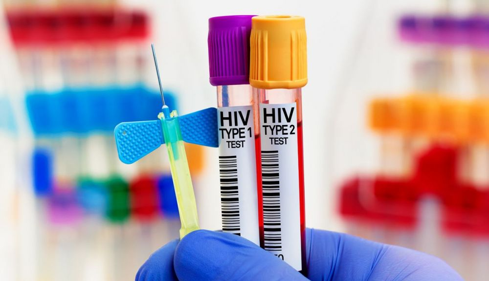 Médico con tubos sanguíneos para la prueba del VIH tipo 1 y tipo 2. Médico con tubos sanguíneos para la prueba del VIH tipo 1 y tipo 2.
