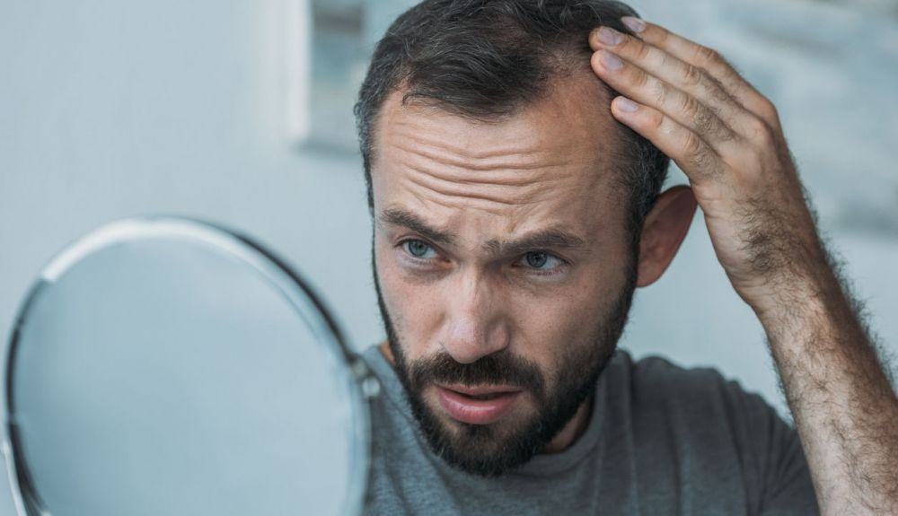 La alopecia es una de las mayores preocupaciones estéticas de hombres y mujeres.