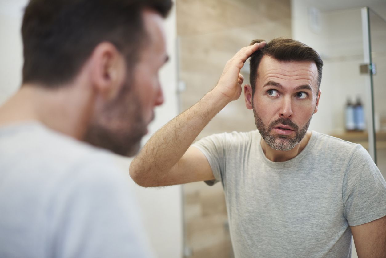 La finasterida es un tratamiento que combate la pérdida del cabello.