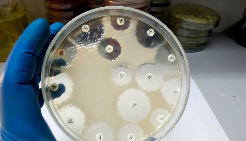 Prueba de susceptibilidad antimicrobiana en la placa de Petri contra bacterias de los pneumoniae Prueba de susceptibilidad antimicrobiana en la placa de Petri contra bacterias de los pneumoniae