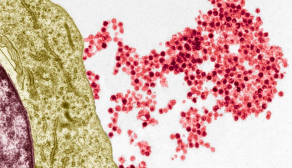 Los virus de Epstein Barr (rojo) emergen de una célula B del sistema inmunitario en esta micrografía electrónica coloreada Los virus de Epstein Barr (rojo) emergen de una célula B del sistema inmunitario en esta micrografía electrónica coloreada