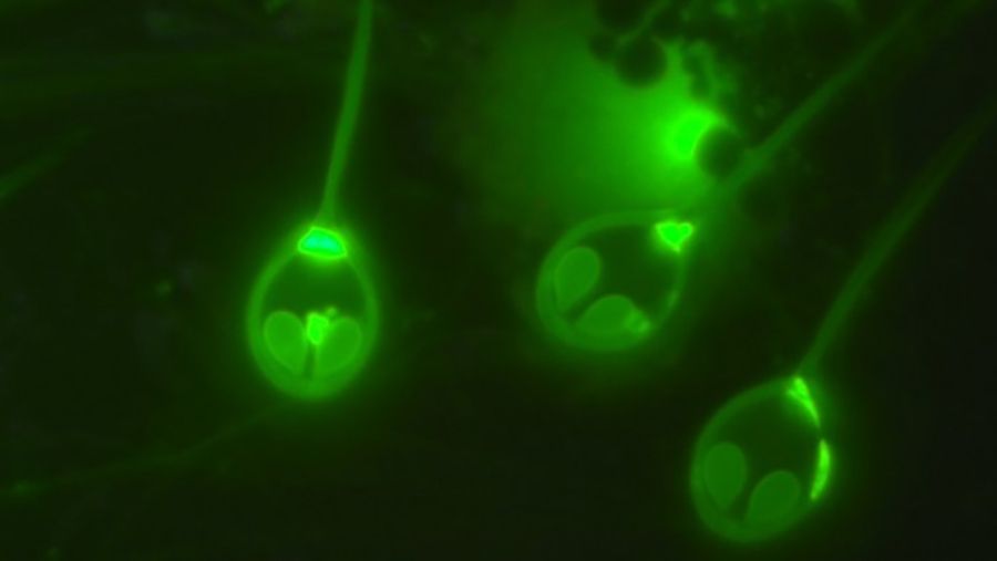 Parásito anaeróbico. Hasta ahora no se había podido zanjar el debate sobre la existencia de animales que no respiren oxígeno.