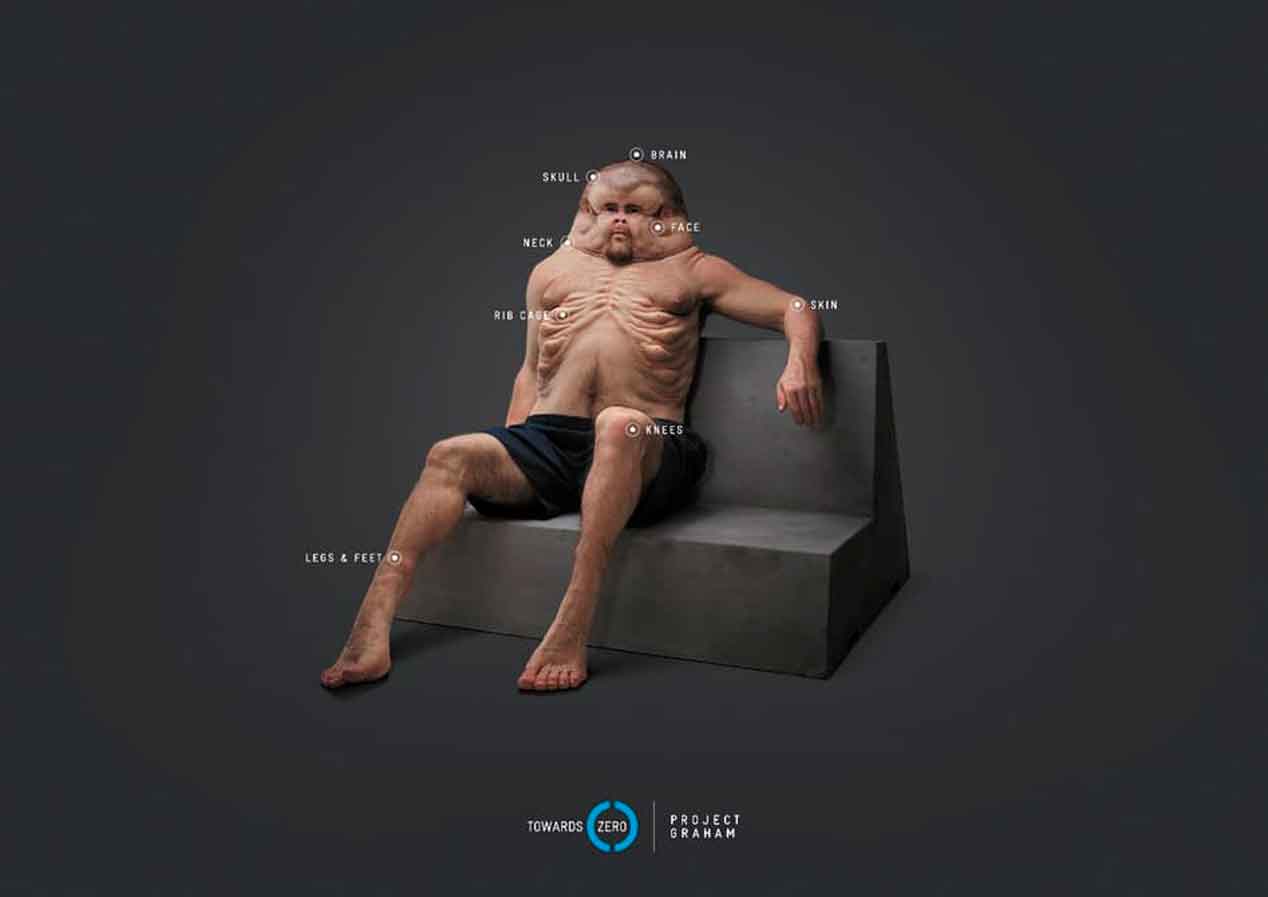 El cuerpo perfecto para sobrevivir a un accidente