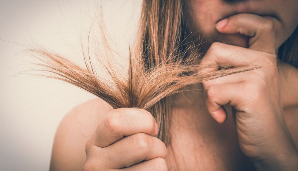 Una mujer preocupada por la caída de su cabello, debido al estrés. Foto: IStock. Autor: andriano_cz Una mujer preocupada por la caída de su cabello, debido al estrés. Foto: IStock. Autor: andriano_cz