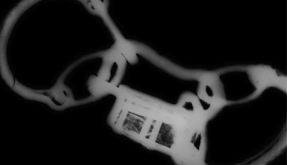 Una radiografía mostró las cadenas de hierro encontradas en los restos arqueológicos Una radiografía mostró las cadenas de hierro encontradas en los restos arqueológicos
