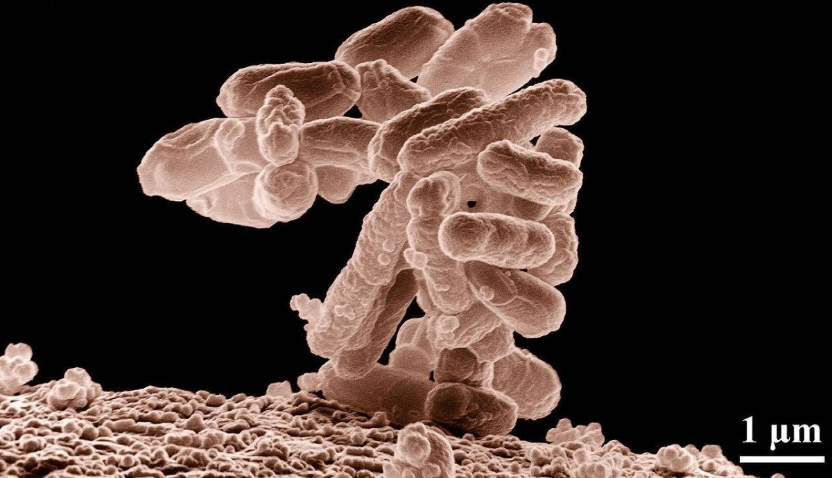 Micrografía de un cúmulo de bacterias E.Coli. Foto: Wikipedia.