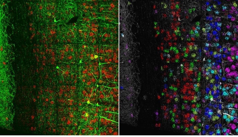 La combinación de microscopía de expansión con secuenciación de ARN (izquierda) revela la organización de las neuronas en la corteza visual del ratón (derecha).