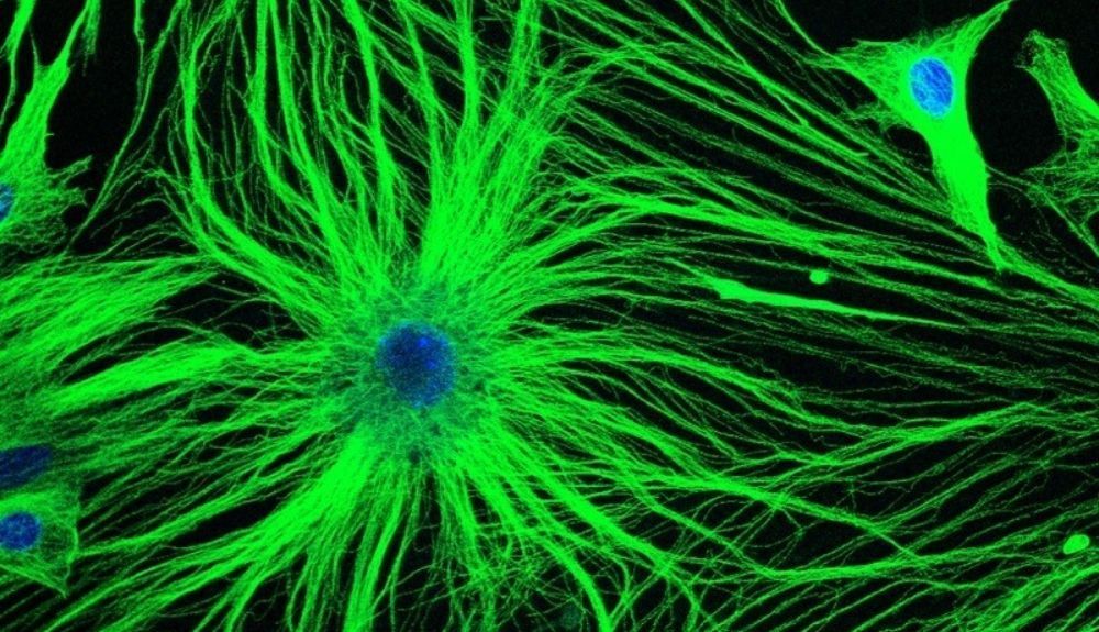 Los astrocitos son células en forma de estrella en el sistema nervioso central que realizan muchas funciones, incluyendo el suministro de nutrientes a las neuronas. Los astrocitos son células en forma de estrella en el sistema nervioso central que realizan muchas funciones, incluyendo el suministro de nutrientes a las neuronas.