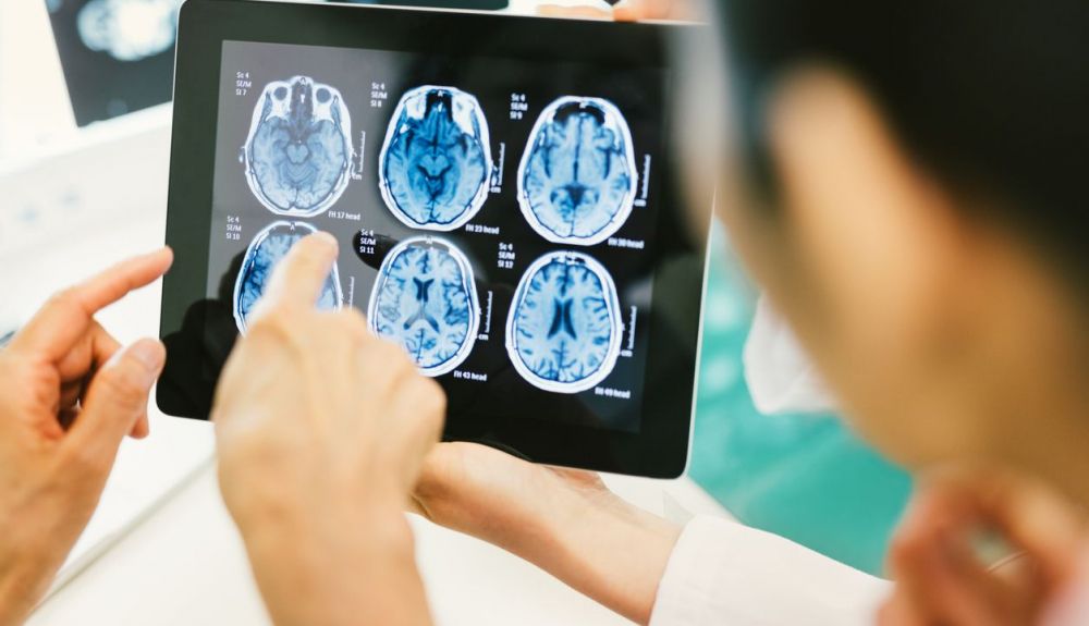 Los investigadores observan cómo los anticuerpos podrían unirse al tejido cerebral, lo que sugiere que podrían dañarlo Los investigadores observan cómo los anticuerpos podrían unirse al tejido cerebral, lo que sugiere que podrían dañarlo
