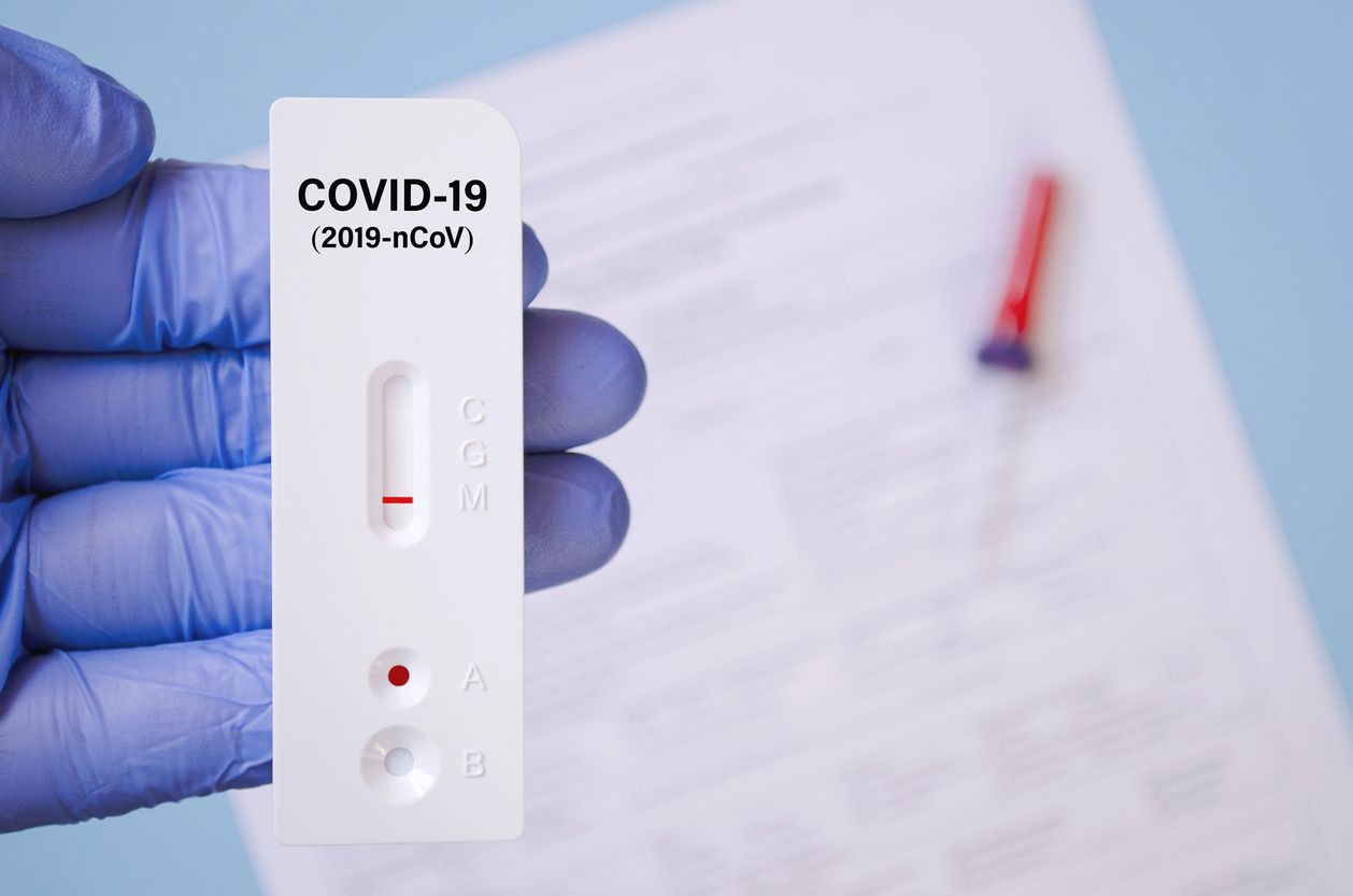 Un test de antígenos no es necesario tras la vacunación contra la Covid 19.