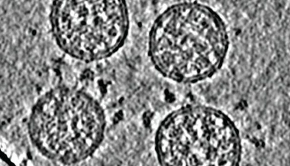 Imágenes de tomografía crioelectrónica de viriones del SARS CoV 2. Foto: Nature.