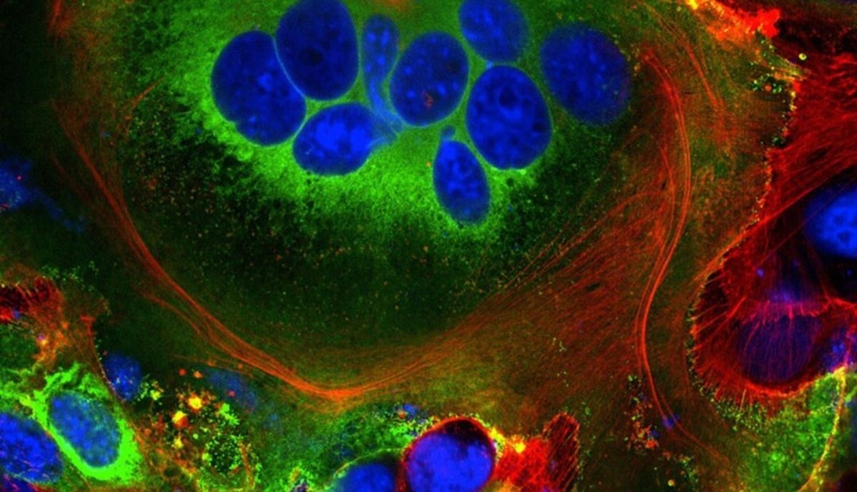 Estructuras celulares fusionadas observadas en células que expresan la proteína espiga sars CoV 2. Imagen del último estudio sobre cómo infecta el coronavirus las células.