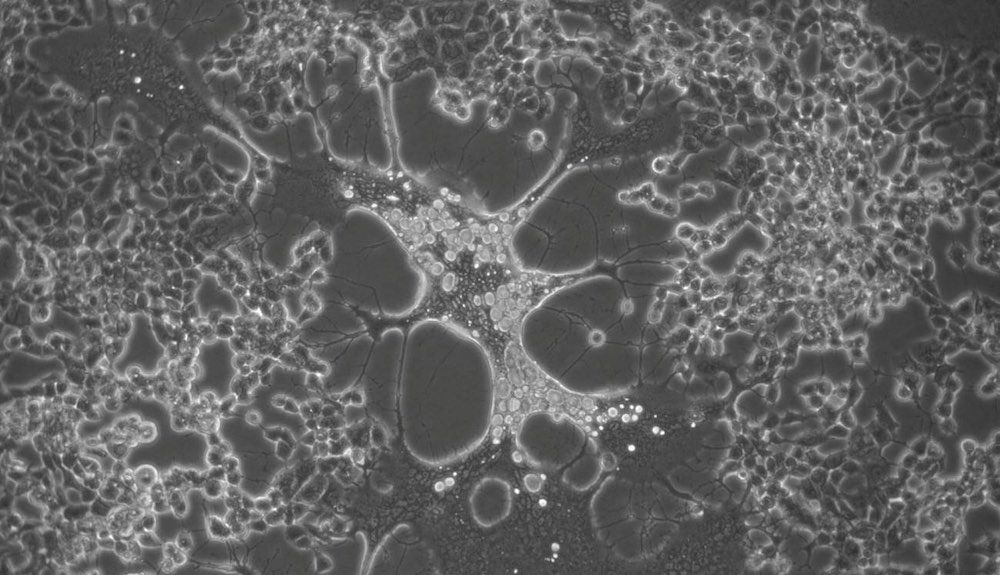 Célula infectada con una variante del virus del herpes simplex generada durante el cultivo celular. / CBM