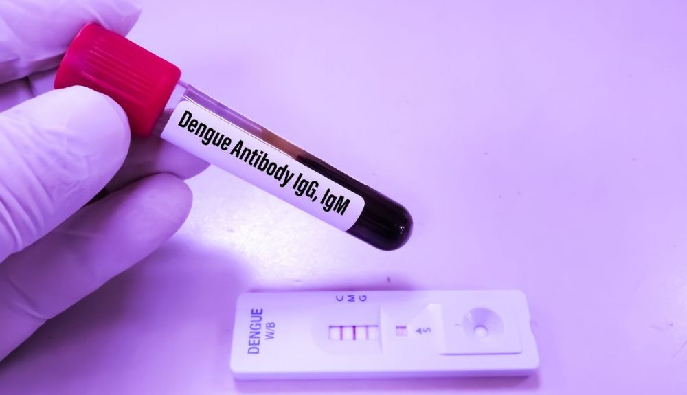 Prueba IgG e IgM de anticuerpos contra el dengue.