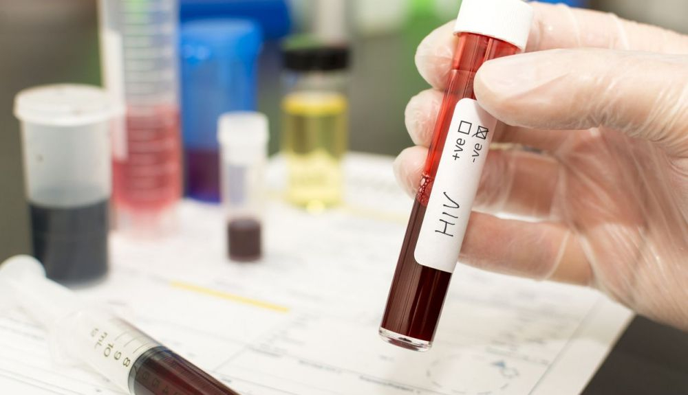 Este tipo de mecanismo se ha observado previamente con el VIH, el virus detrás del SIDA Este tipo de mecanismo se ha observado previamente con el VIH, el virus detrás del SIDA