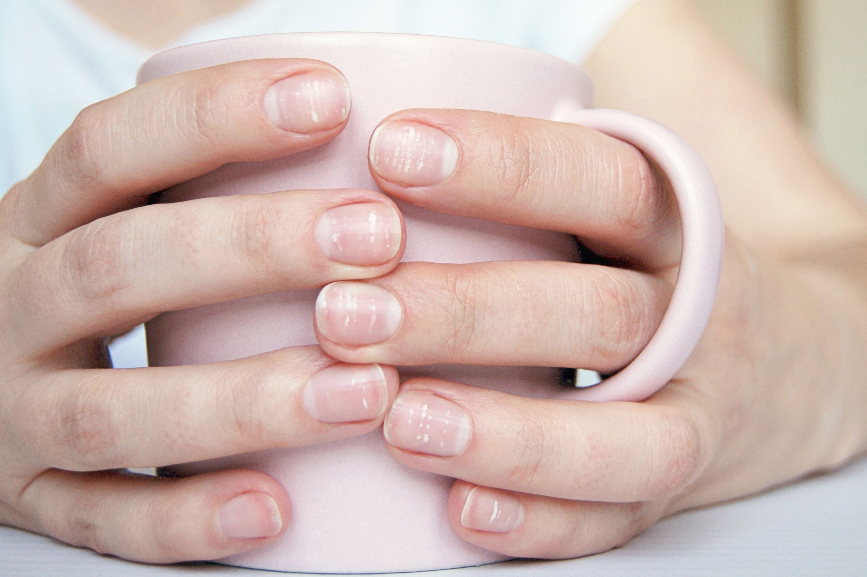 Los cambios en las uñas pueden deberse a una enfermedad.